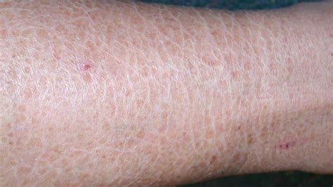 sel itch|Skin Conditions that Itch: Causes, Diagnosis, & Treatment.